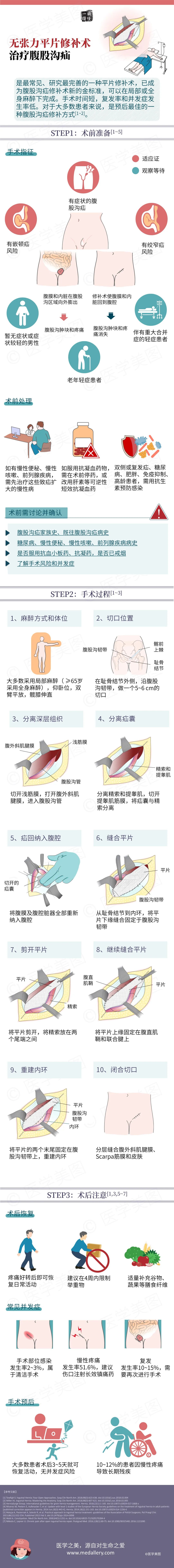 简单三步丨无张力平片修补术治疗腹股沟疝，无张力平片修补术治疗腹股沟疝，简单三步解决烦恼